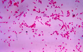 Fusobacterium sp.
